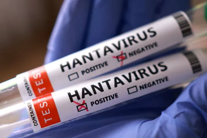 Test tubes labelled Hantavirus positive and negative (Photo/Reuters)