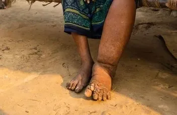 ފައިލޭރިޔާ ބަލި ޖެހިފައިވާ ބަޔަކު ކުޅުދުއްފުށިން ފެނިއްޖެ
