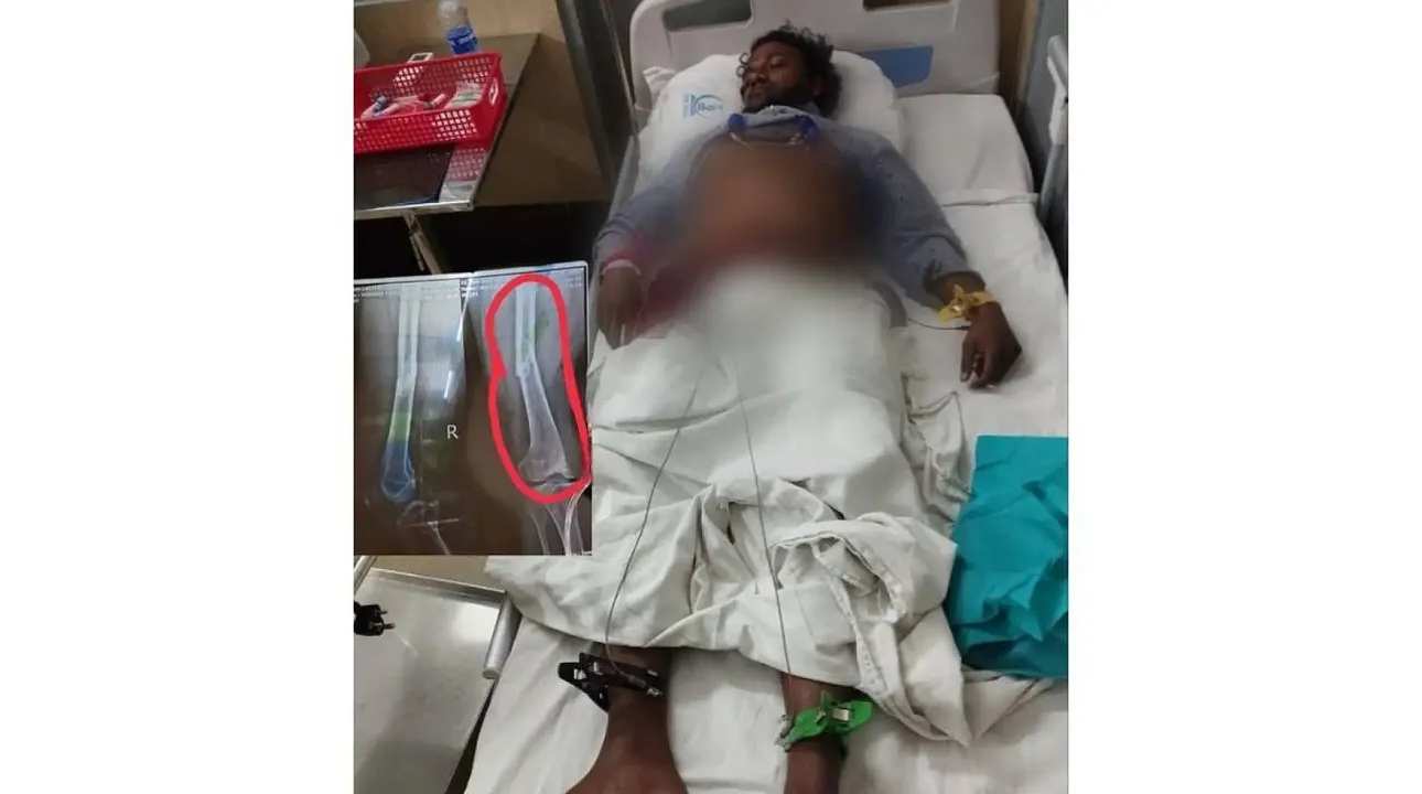 ހައިޝަމްގެ ފައި ބިނދިގެން ފަރުވާ ދެނީ