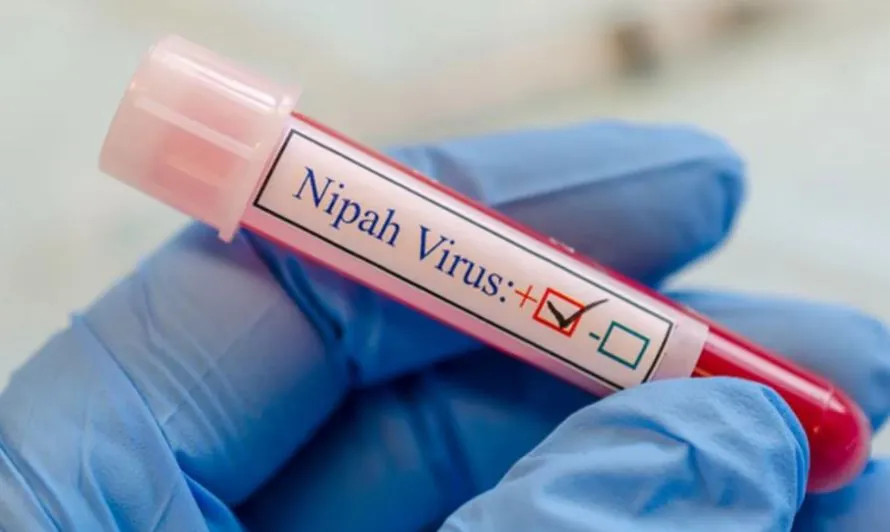 ނުރައްކާތެރި ނިޕާ ވައިރަސް ރާއްޖެ އެތެރެވުމުގެ ފުރުޞަތު ކުޑަކަމަށް އެޗްޕީއޭއިން ބުނެފި