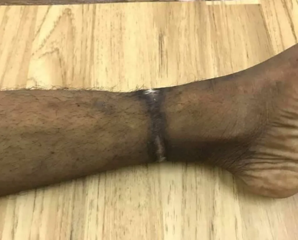 N/A